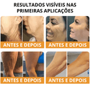 Botox Firmador e Redutor de Rugas - Bee Venom