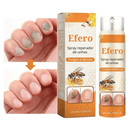 Efero Spray - Restaura Unhas e Elimina Fungos