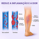 Creme Redutor De Varizes, Dores e Inchaço - Variflex