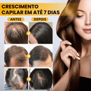 Sérum Para Crescimento Capilar - Biotin™ 7 Dias