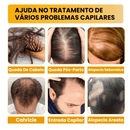 Sérum Para Crescimento Capilar - Biotin™ 7 Dias