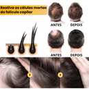 Sérum Para Crescimento Capilar - Biotin™ 7 Dias