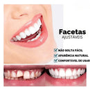 Facetas Dentárias Universal Smile [Últimas Unidades]