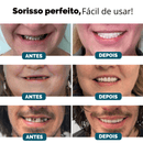 Facetas Dentárias Universal Smile [Últimas Unidades]