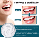 Facetas Dentárias Universal Smile [Últimas Unidades]